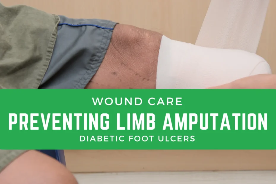 Preventing Limb Amputation-Diabetic Foot Ulcers